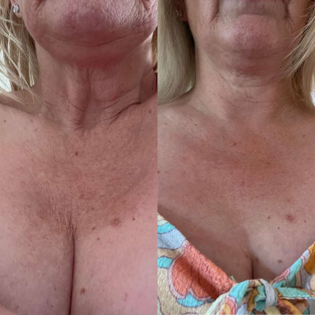 Peter Thomas Roth - Péptide TECH